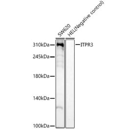 Western Blot - Anti-ITPR3 Antibody [ARC59549] (A309393) - Antibodies.com