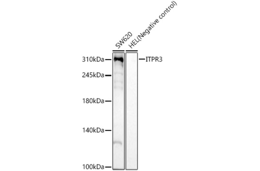 Western Blot - Anti-ITPR3 Antibody [ARC59549] (A309393) - Antibodies.com