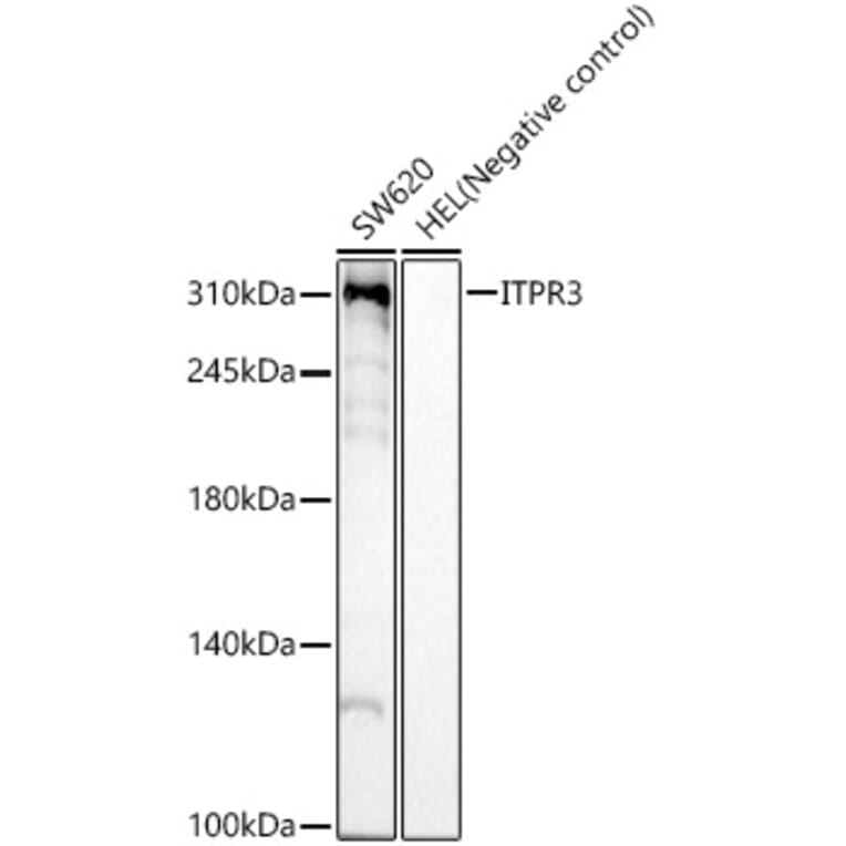 Western Blot - Anti-ITPR3 Antibody [ARC59549] (A309393) - Antibodies.com