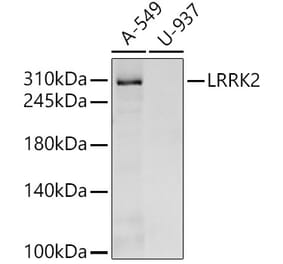 Western Blot - Anti-LRRK2 Antibody [ARC55202] (A309401) - Antibodies.com