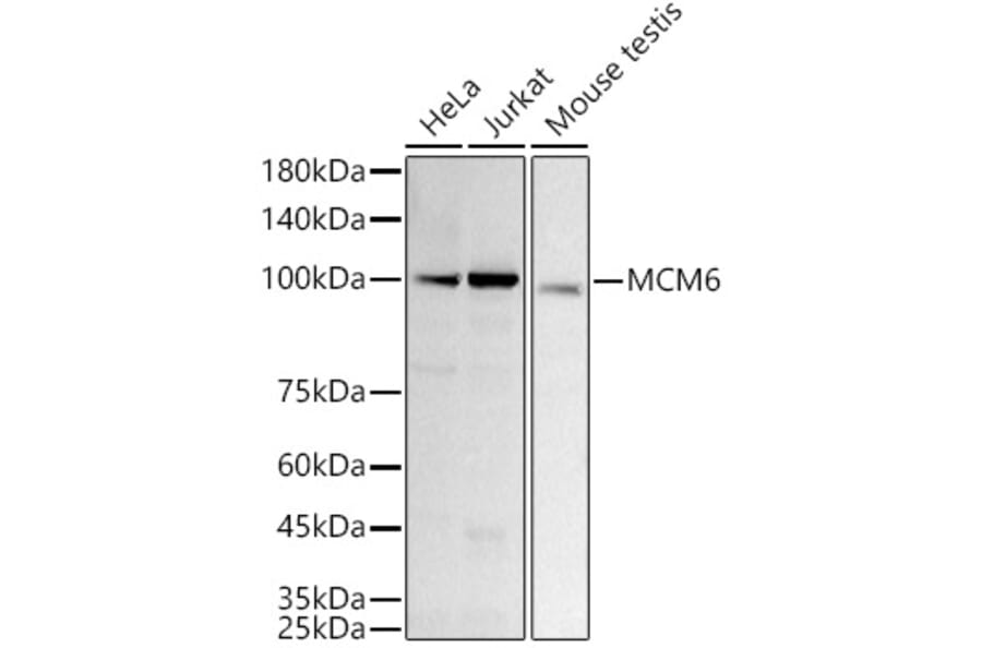 Western Blot - Anti-MCM6 Antibody [ARC3057] (A309402) - Antibodies.com