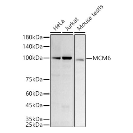 Western Blot - Anti-MCM6 Antibody [ARC3057] (A309402) - Antibodies.com