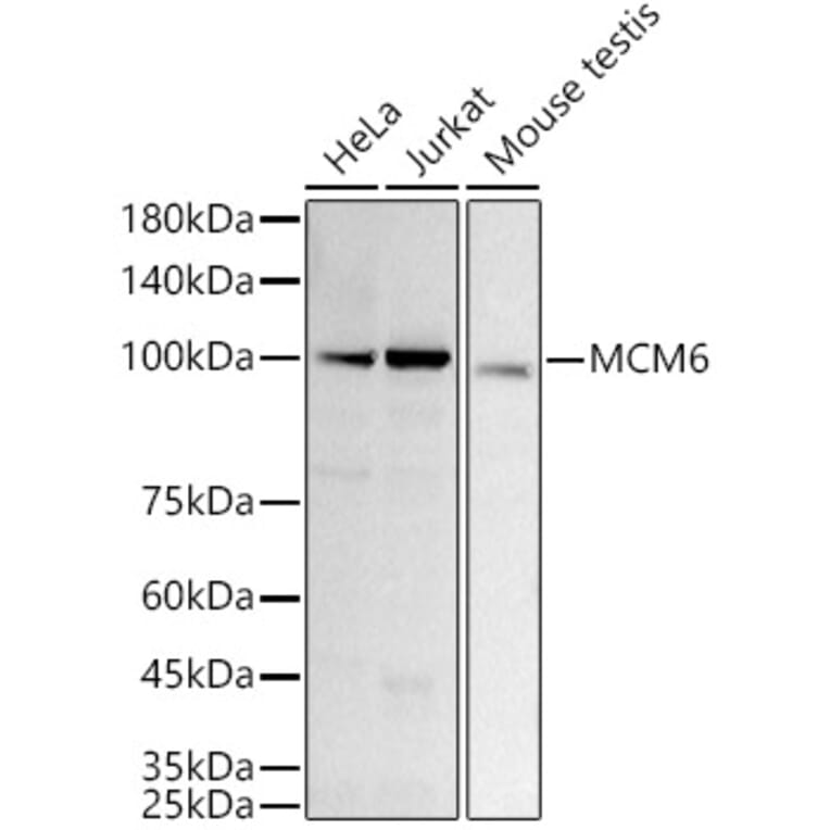 Western Blot - Anti-MCM6 Antibody [ARC3057] (A309402) - Antibodies.com