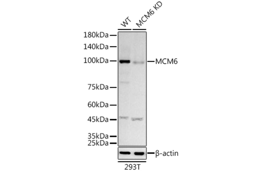 Western Blot - Anti-MCM6 Antibody [ARC3057] (A309402) - Antibodies.com