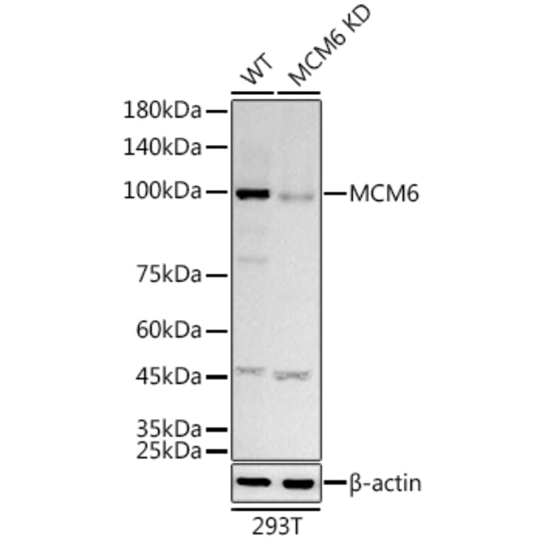 Western Blot - Anti-MCM6 Antibody [ARC3057] (A309402) - Antibodies.com