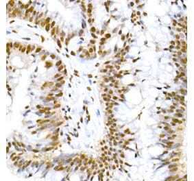 Immunohistochemistry - Anti-MDM2 (phospho Ser166) Antibody [ARC2909] (A309403) - Antibodies.com