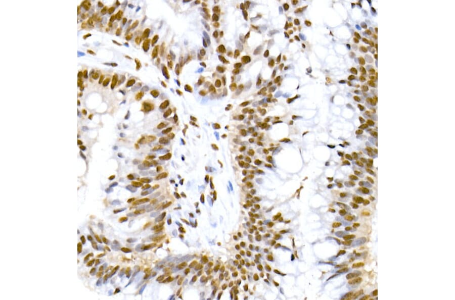 Immunohistochemistry - Anti-MDM2 (phospho Ser166) Antibody [ARC2909] (A309403) - Antibodies.com