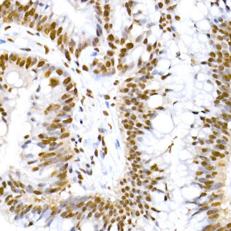 Immunohistochemistry - Anti-MDM2 (phospho Ser166) Antibody [ARC2909] (A309403) - Antibodies.com