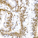 Immunohistochemistry - Anti-MDM2 (phospho Ser166) Antibody [ARC2909] (A309403) - Antibodies.com