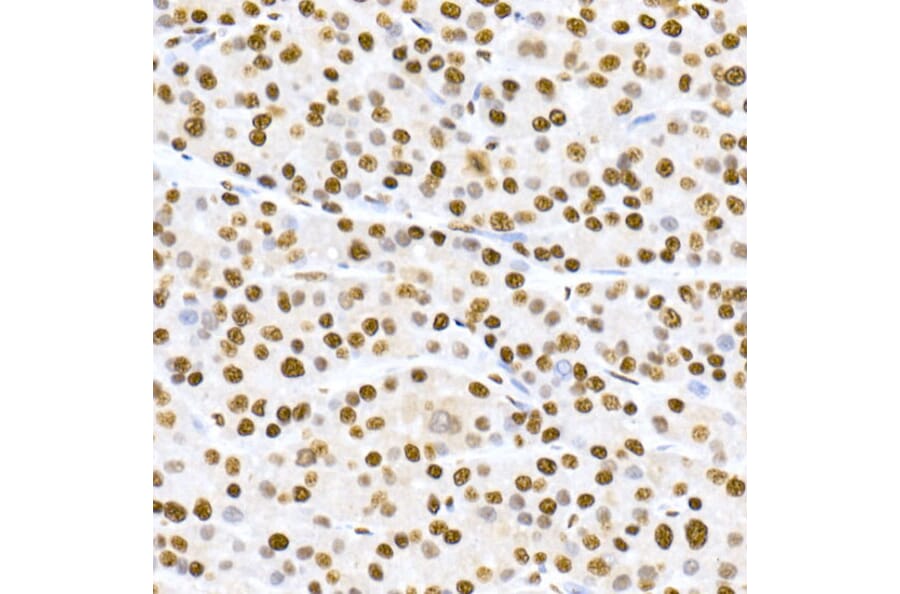 Immunohistochemistry - Anti-MDM2 (phospho Ser166) Antibody [ARC2909] (A309403) - Antibodies.com