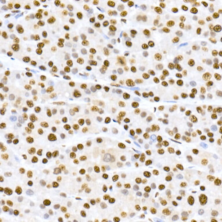 Immunohistochemistry - Anti-MDM2 (phospho Ser166) Antibody [ARC2909] (A309403) - Antibodies.com