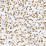 Immunohistochemistry - Anti-MDM2 (phospho Ser166) Antibody [ARC2909] (A309403) - Antibodies.com