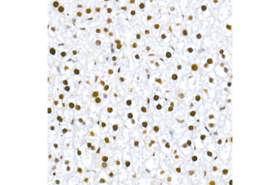 Immunohistochemistry - Anti-MDM2 (phospho Ser166) Antibody [ARC2909] (A309403) - Antibodies.com