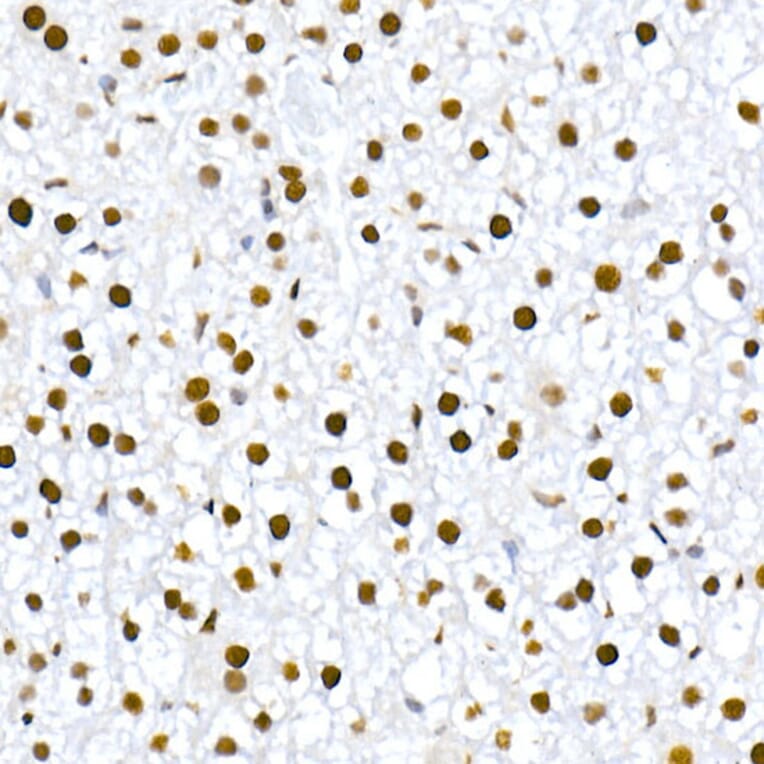 Immunohistochemistry - Anti-MDM2 (phospho Ser166) Antibody [ARC2909] (A309403) - Antibodies.com