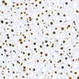 Immunohistochemistry - Anti-MDM2 (phospho Ser166) Antibody [ARC2909] (A309403) - Antibodies.com