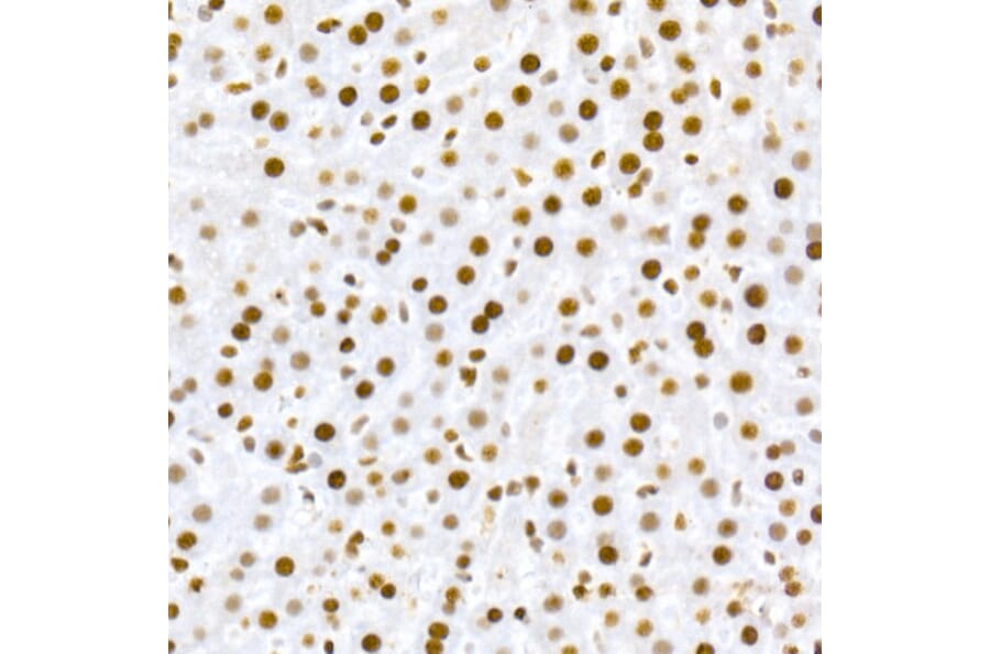 Immunohistochemistry - Anti-MDM2 (phospho Ser166) Antibody [ARC2909] (A309403) - Antibodies.com