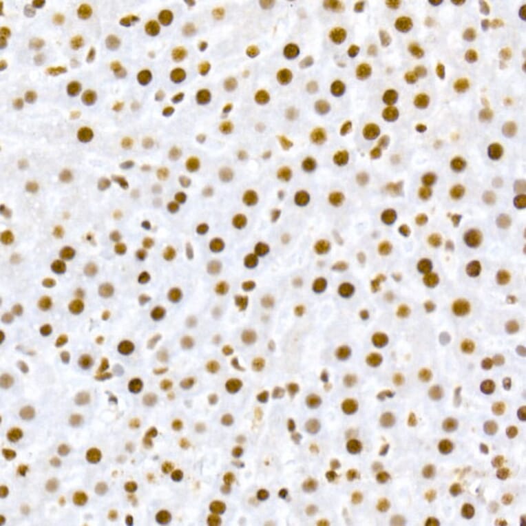 Immunohistochemistry - Anti-MDM2 (phospho Ser166) Antibody [ARC2909] (A309403) - Antibodies.com