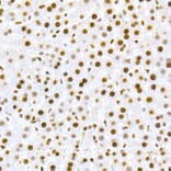 Immunohistochemistry - Anti-MDM2 (phospho Ser166) Antibody [ARC2909] (A309403) - Antibodies.com
