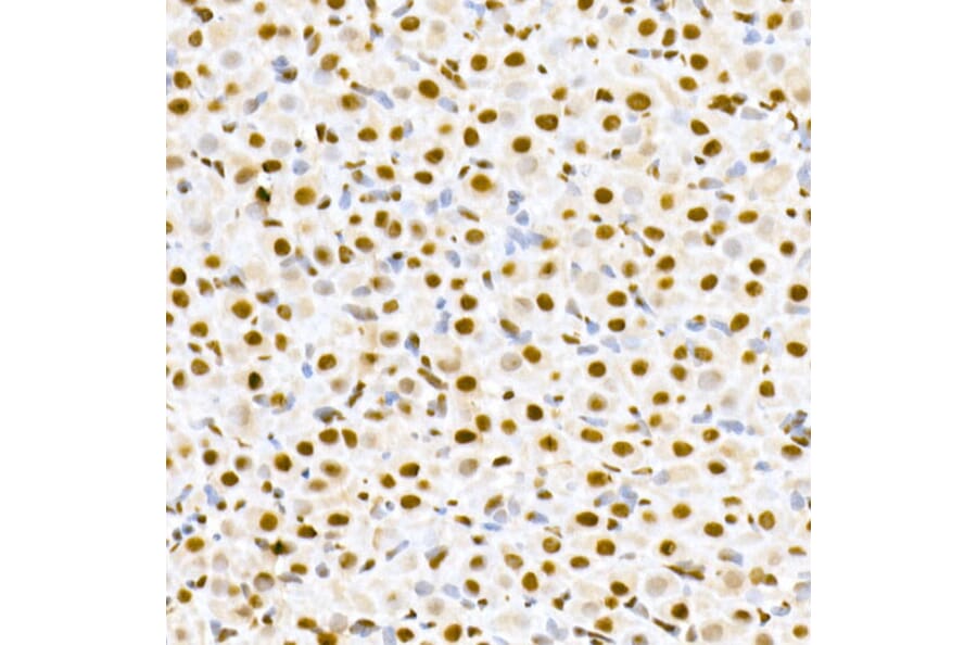 Immunohistochemistry - Anti-MDM2 (phospho Ser166) Antibody (A309403) - Antibodies.com