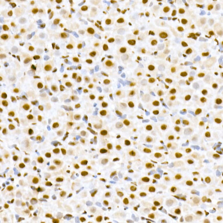 Immunohistochemistry - Anti-MDM2 (phospho Ser166) Antibody (A309403) - Antibodies.com