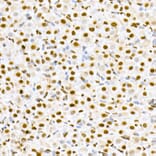 Immunohistochemistry - Anti-MDM2 (phospho Ser166) Antibody (A309403) - Antibodies.com