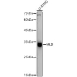 Western Blot - Anti-MLD Antibody [ARC2977] (A309407) - Antibodies.com
