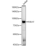 Western Blot - Anti-MLH1 Antibody [AMC0417] (A309408) - Antibodies.com