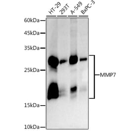 Western Blot - Anti-MMP7 Antibody [ARC5088-01] (A309409) - Antibodies.com