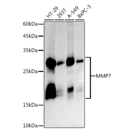 Western Blot - Anti-MMP7 Antibody [ARC5088-01] (A309409) - Antibodies.com