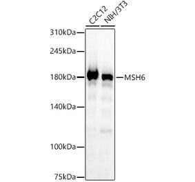 Western Blot - Anti-MSH6 Antibody [ARC57727] (A309410) - Antibodies.com