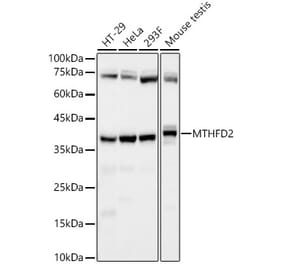 Western Blot - Anti-MTHFD2 Antibody [ARC58228] (A309411) - Antibodies.com