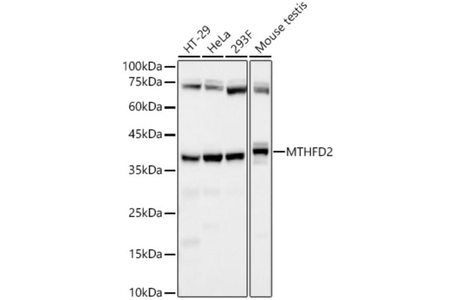 Western Blot - Anti-MTHFD2 Antibody [ARC58228] (A309411) - Antibodies.com