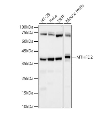 Western Blot - Anti-MTHFD2 Antibody [ARC58228] (A309411) - Antibodies.com