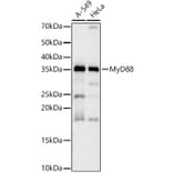 Western Blot - Anti-MyD88 Antibody [ARC52507 + ARC52509] (A309412) - Antibodies.com