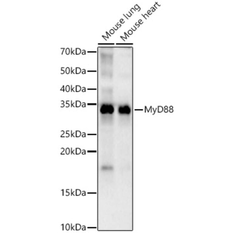 Western Blot - Anti-MyD88 Antibody [ARC52507 + ARC52509] (A309412) - Antibodies.com