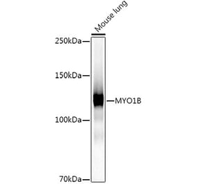 Western Blot - Anti-MYO1B Antibody [ARC2990] (A309413) - Antibodies.com