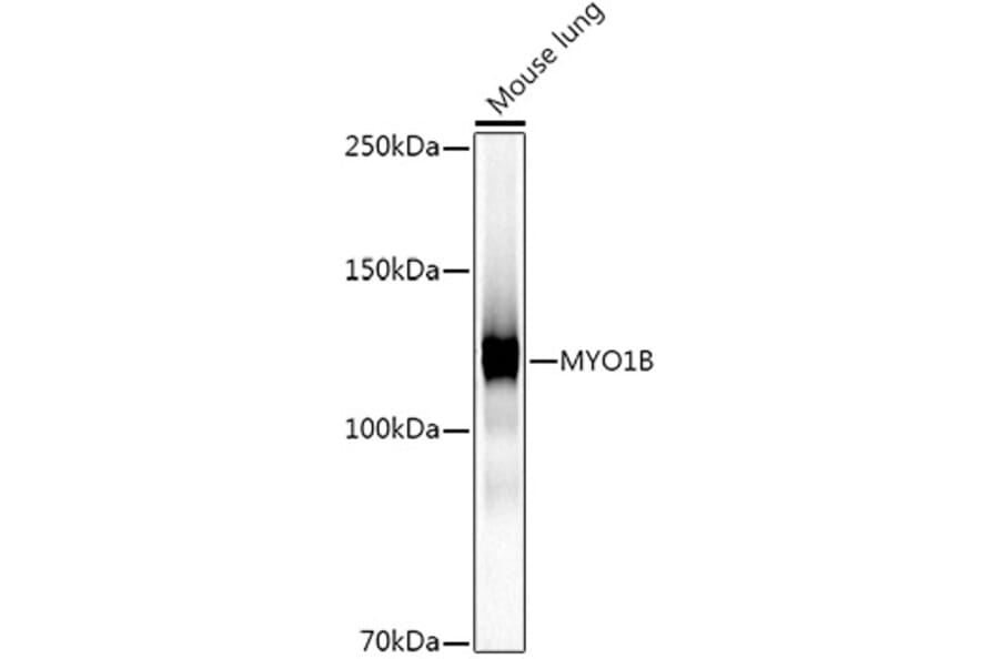 Western Blot - Anti-MYO1B Antibody [ARC2990] (A309413) - Antibodies.com