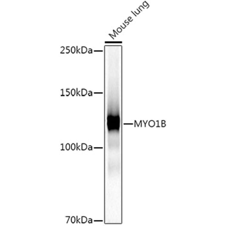 Western Blot - Anti-MYO1B Antibody [ARC2990] (A309413) - Antibodies.com