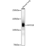 Western Blot - Anti-MYO1B Antibody [ARC2990] (A309413) - Antibodies.com
