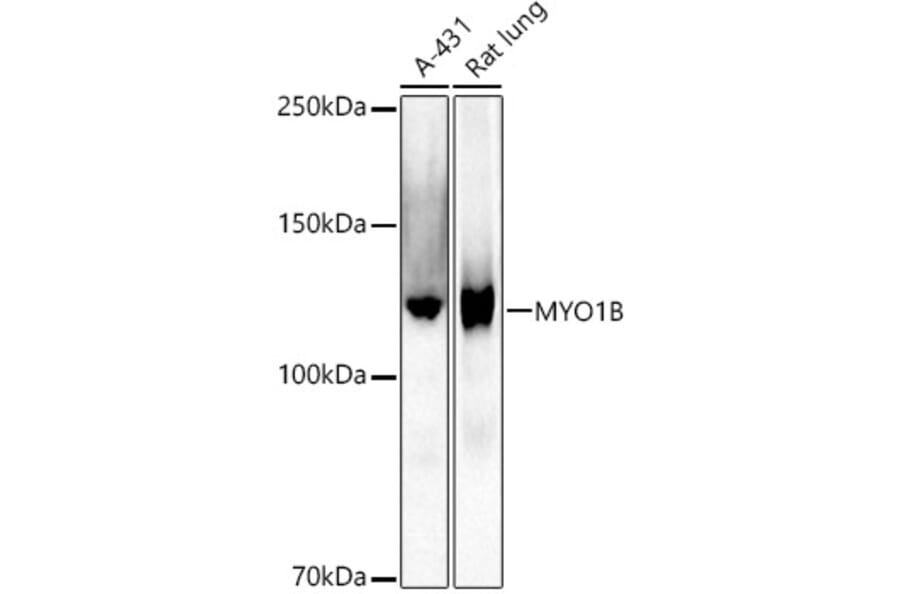 Western Blot - Anti-MYO1B Antibody [ARC2990] (A309413) - Antibodies.com