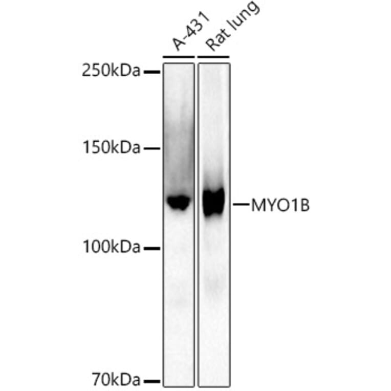 Western Blot - Anti-MYO1B Antibody [ARC2990] (A309413) - Antibodies.com
