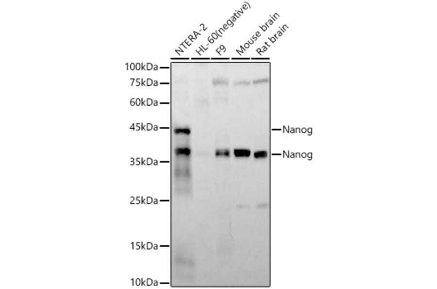 Western Blot - Anti-Nanog Antibody [ARC58438] (A309414) - Antibodies.com