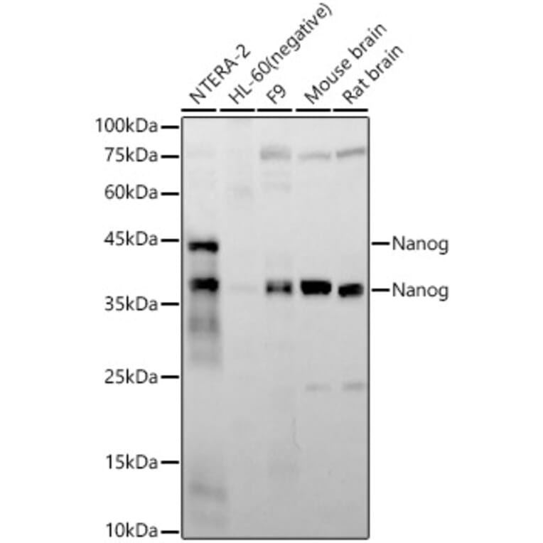 Western Blot - Anti-Nanog Antibody [ARC58438] (A309414) - Antibodies.com