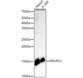 Western Blot - Anti-NDUFC2 Antibody [ARC3020] (A309417) - Antibodies.com
