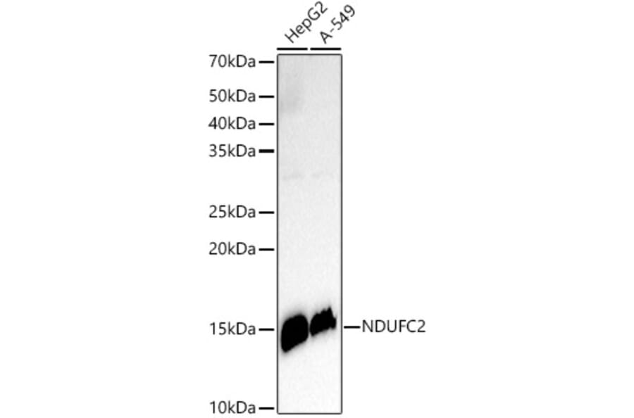 Western Blot - Anti-NDUFC2 Antibody [ARC3020] (A309417) - Antibodies.com