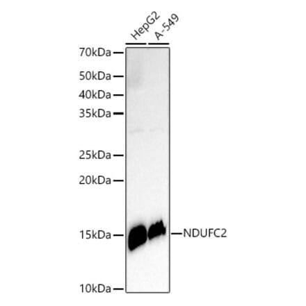 Western Blot - Anti-NDUFC2 Antibody [ARC3020] (A309417) - Antibodies.com