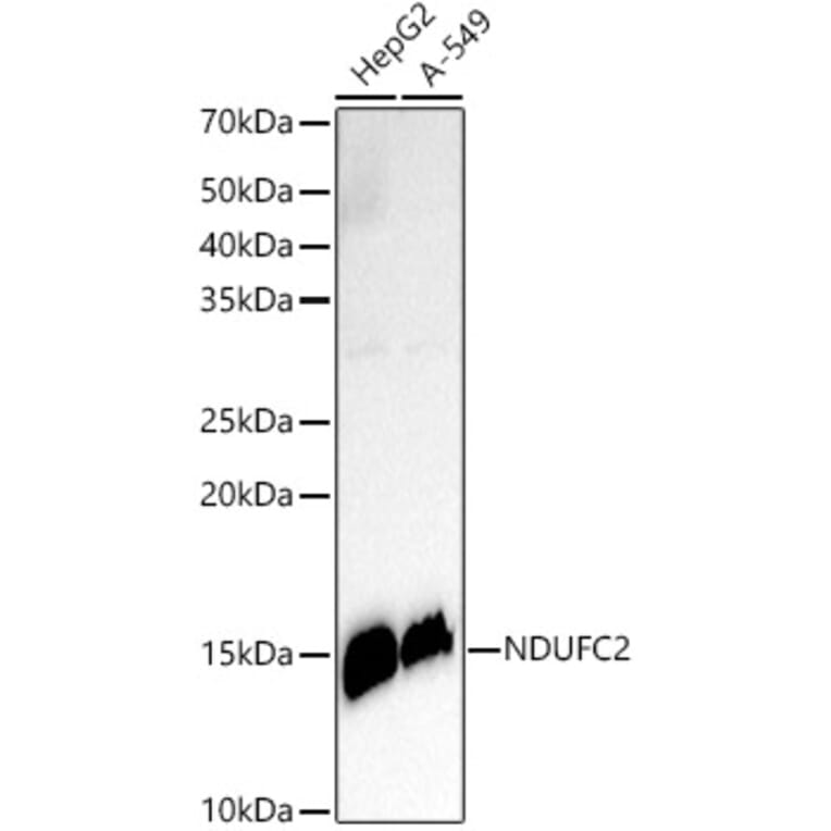 Western Blot - Anti-NDUFC2 Antibody [ARC3020] (A309417) - Antibodies.com