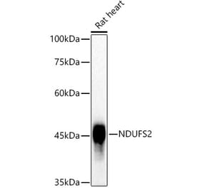 Western Blot - Anti-NDUFS2 Antibody [ARC3018] (A309418) - Antibodies.com