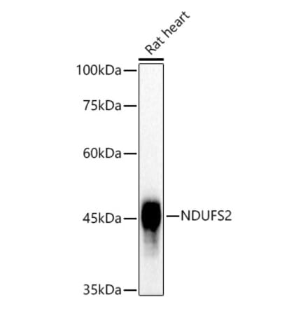 Western Blot - Anti-NDUFS2 Antibody [ARC3018] (A309418) - Antibodies.com