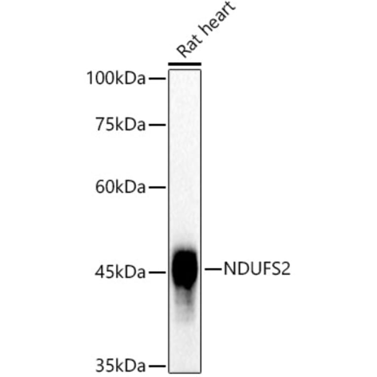 Western Blot - Anti-NDUFS2 Antibody [ARC3018] (A309418) - Antibodies.com